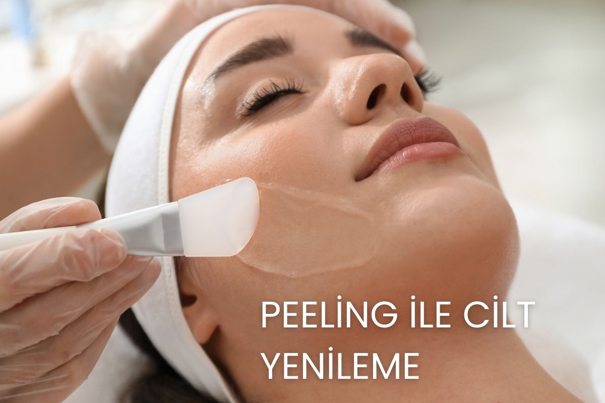 Peeling İle cİlt yenİleme